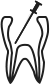Root Canal