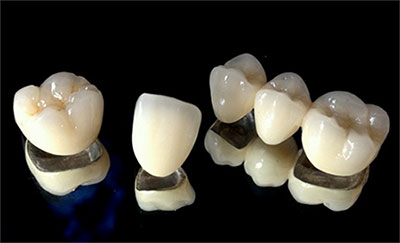 Crowns